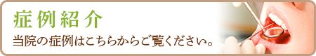 当院の症例はこちらからご覧ください。