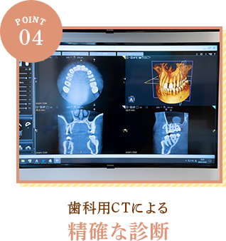 POINT04 歯科用CTによる精確な診断