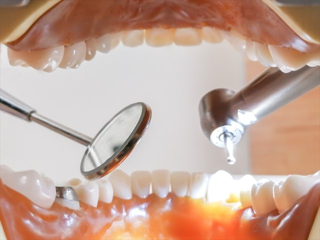 歯がエナメル質を失うのはなぜ?失うとどうなる?