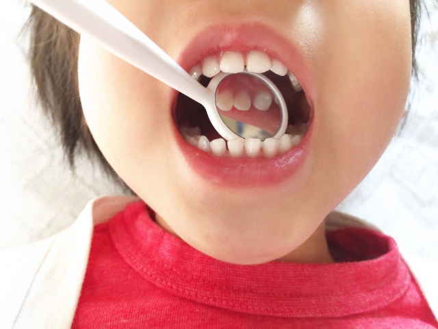 子どもの歯に見られる“中心結節”とは?～リスクや治療法～