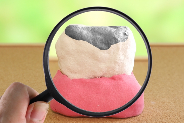 虫歯の詰め物を誤って飲み込んでしまったらどうする？