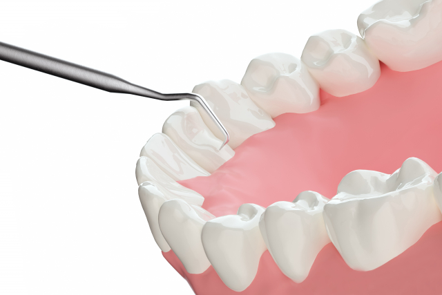 【新潟の歯医者】根管治療で歯を残すべき理由とは?
