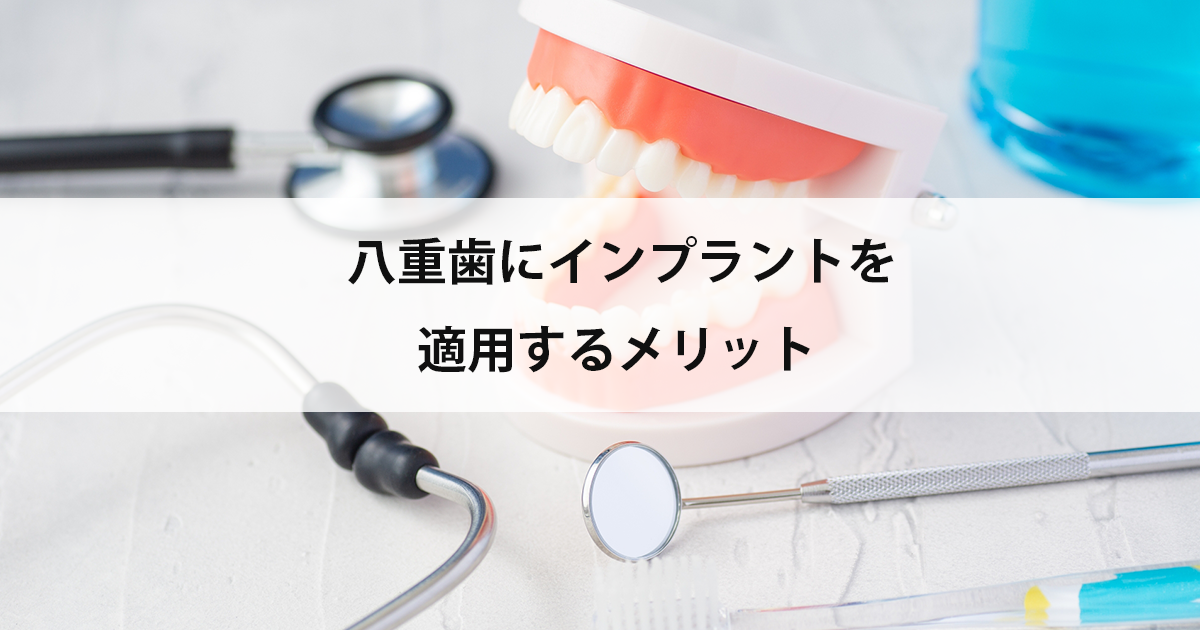 【新潟の歯医者でインプラント】八重歯にインプラントを適用するメリット