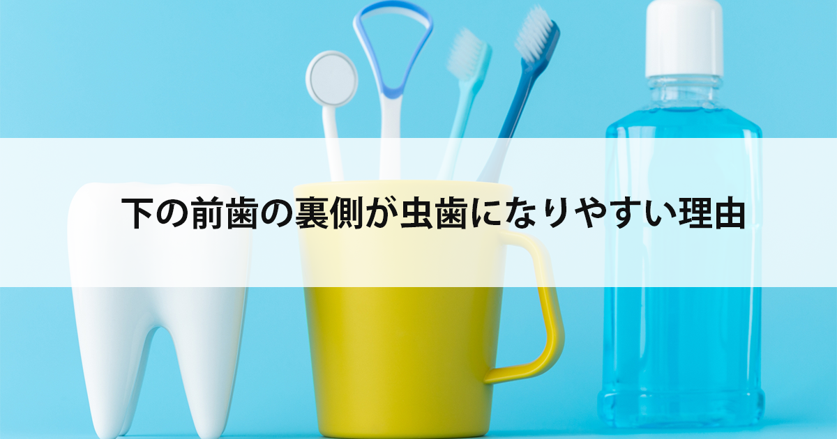 【新潟の歯医者で虫歯治療】下の前歯の裏側が虫歯になりやすい理由