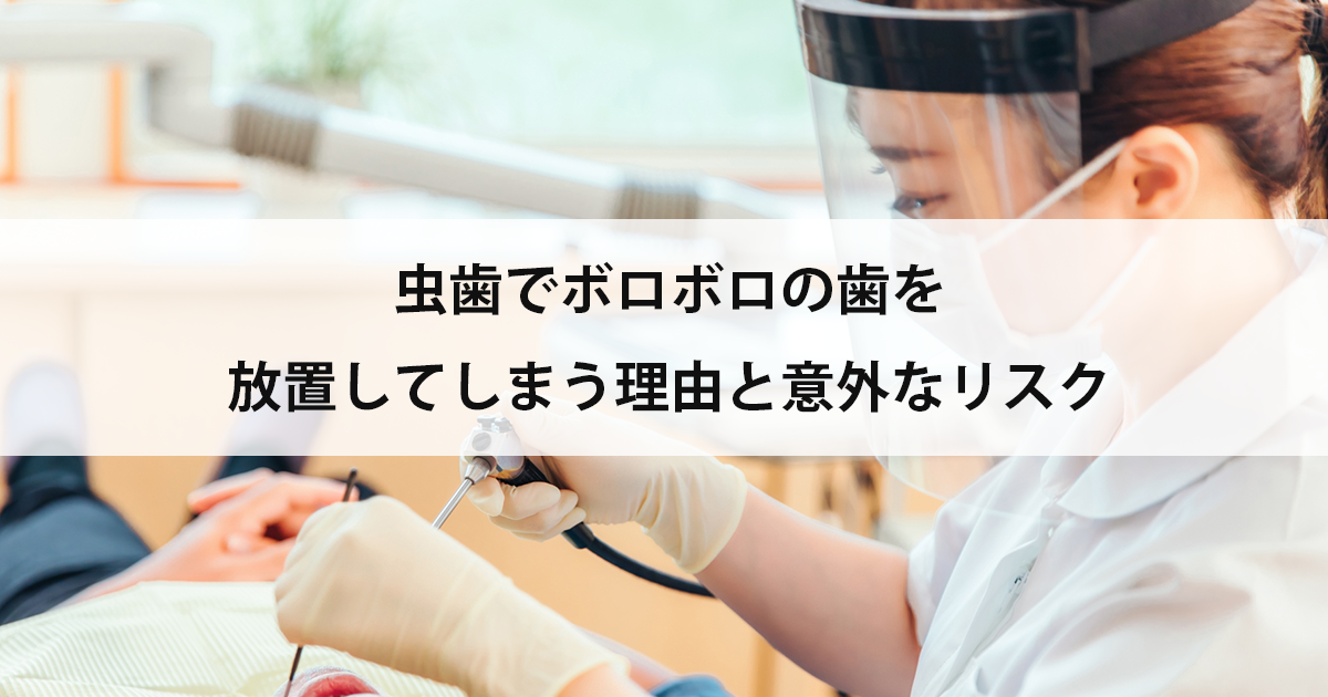 【新潟の歯医者で虫歯治療】虫歯でボロボロの歯を放置してしまう理由と意外なリスク