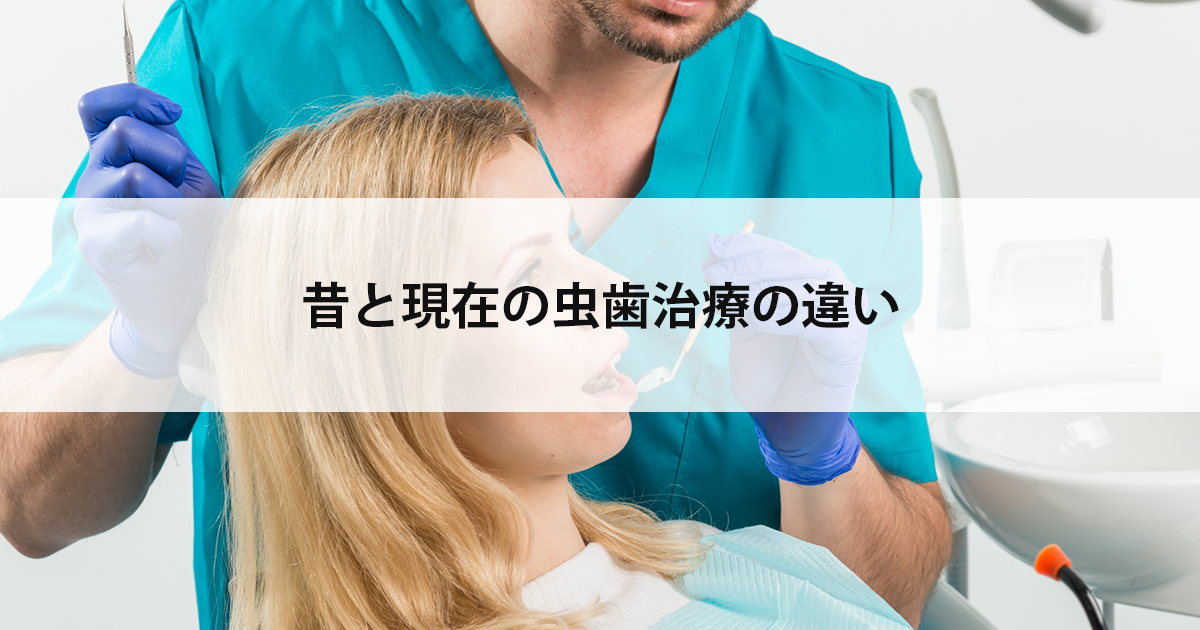 【新潟の歯医者で虫歯治療】昔と現在の虫歯治療の違い