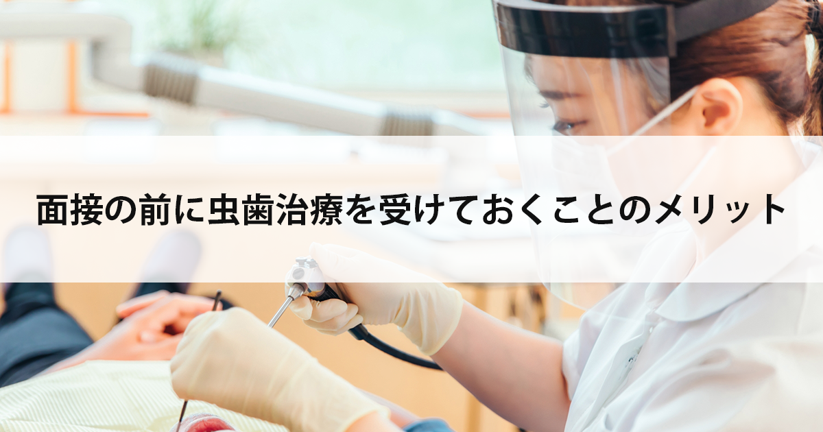 【新潟の歯医者で虫歯治療】面接の前に虫歯治療を受けておくことのメリット