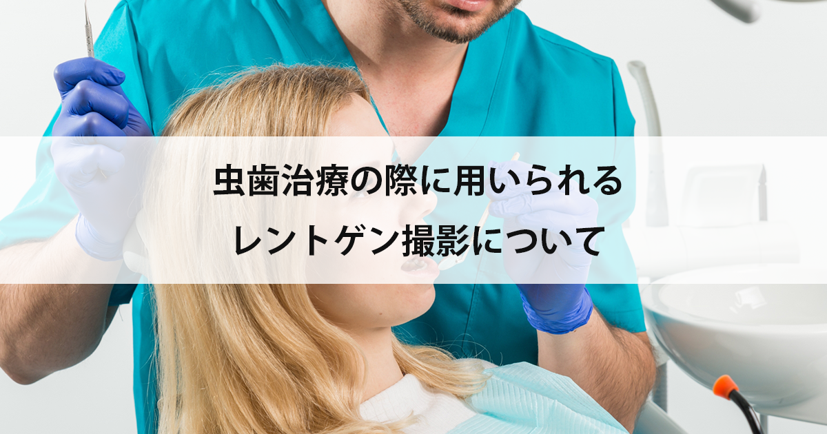【新潟の歯医者で虫歯治療】虫歯治療の際に用いられるレントゲン撮影について