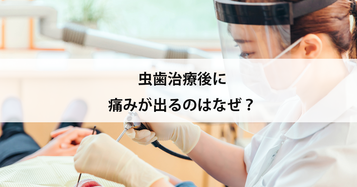 【新潟の歯医者で虫歯治療】虫歯治療後に痛みが出るのはなぜ?