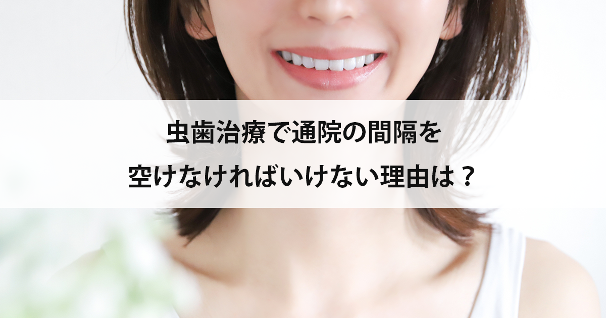 【新潟の歯医者で虫歯治療】虫歯治療で通院の間隔を空けなければいけない理由は?
