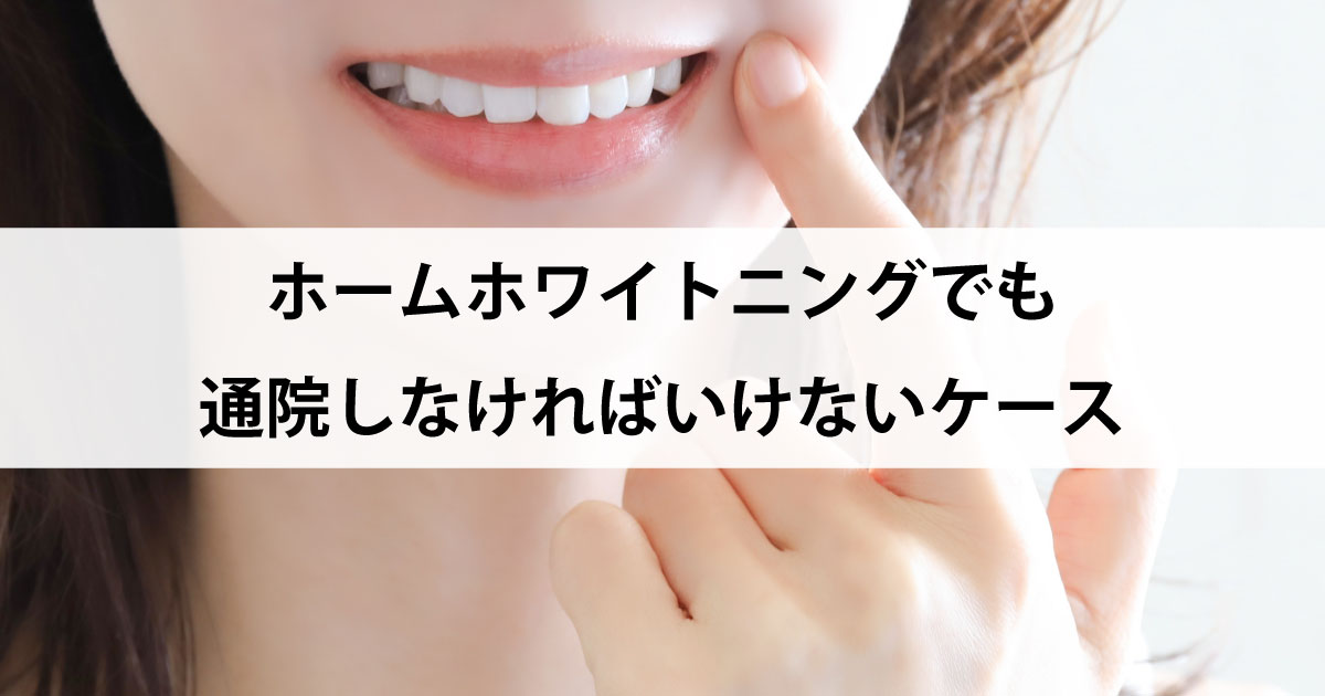 【新潟市の歯医者でホワイトニング】ホームホワイトニングでも通院しなければいけないケース