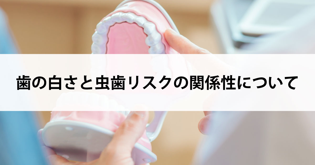 【新潟の歯医者・予防歯科】歯の白さと虫歯リスクの関係性について