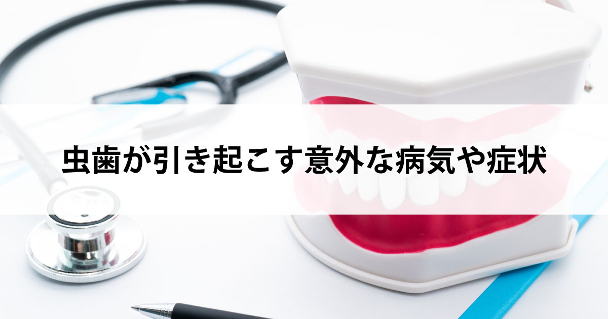 【新潟の歯医者で虫歯治療】虫歯が引き起こす意外な病気や症状