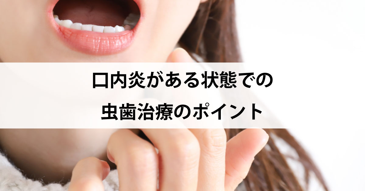 【新潟の歯医者で虫歯治療】口内炎がある状態での虫歯治療のポイント